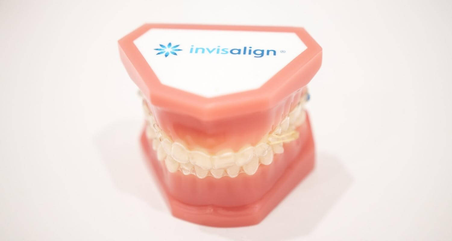 What Are the Pros and Cons of Invisalign Aligners vs Braces?