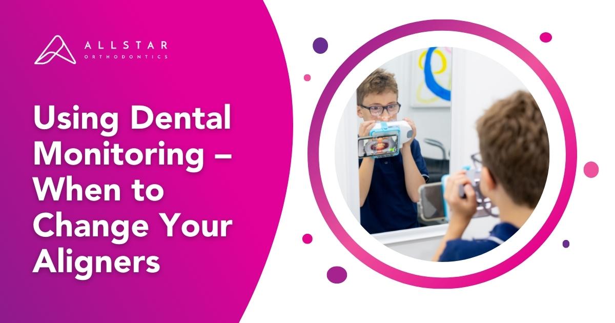 Using Dental Monitoring – When to Change Your Aligners