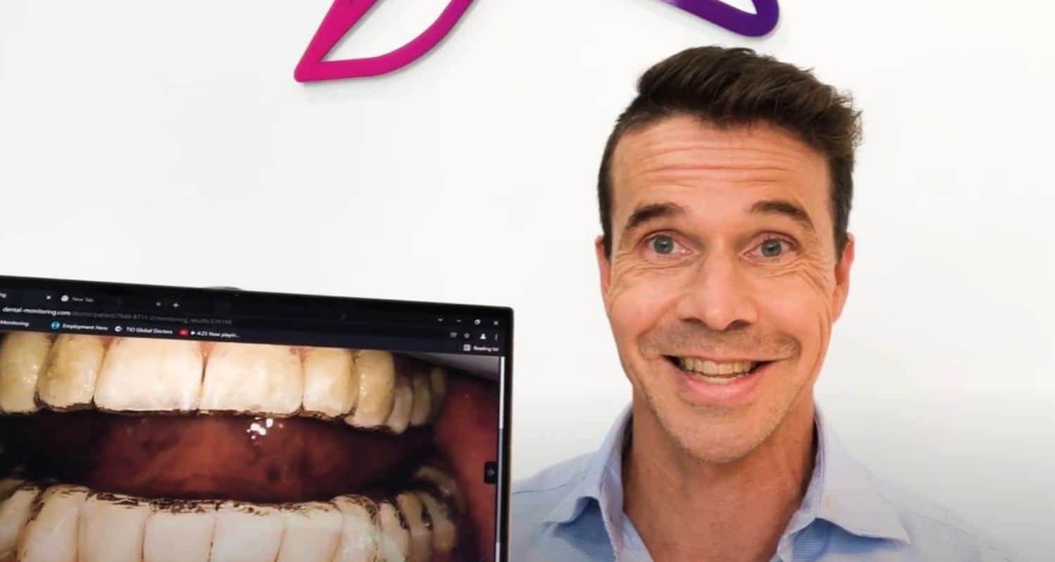 Using Dental Monitoring – When to Change Your Aligners  - Brisbane Queensland, Fortitude Valley & Albany Creek - Allstar Orthodontics