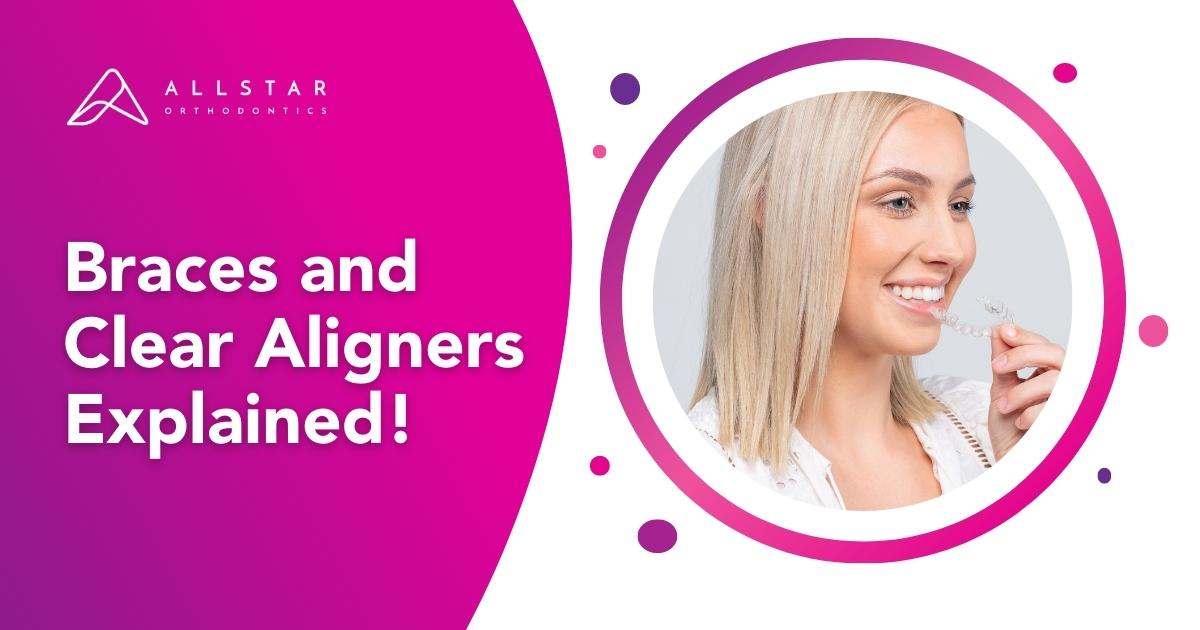 Braces and Clear Aligners Explained!
