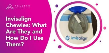 Invisalign Chewies: What Are They and How Do I Use Them?