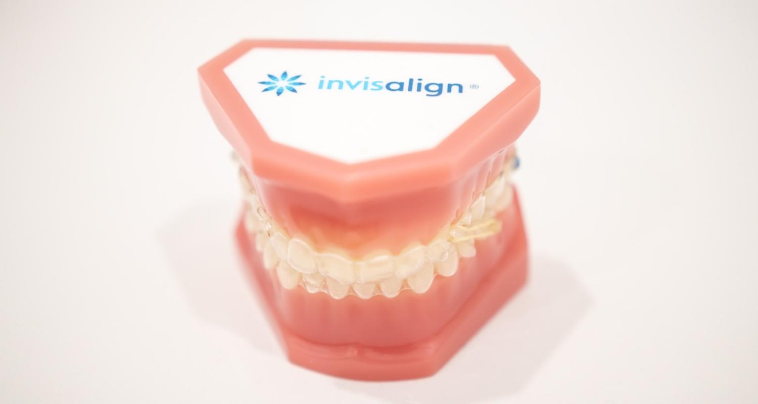 What Are The Pros and Cons Of Invisalign Aligners vs Braces - Brisbane, Fortitude Valley & Albany Creek - Allstar Orthodontics