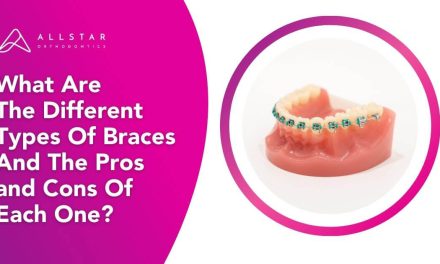 What Are the Different Types of Braces and the Pros and Cons of Each One?